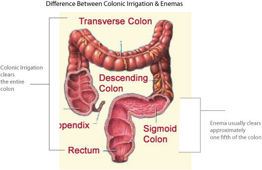 Colonics Vs Enema - whats the Difference - Dublin Vitality Center